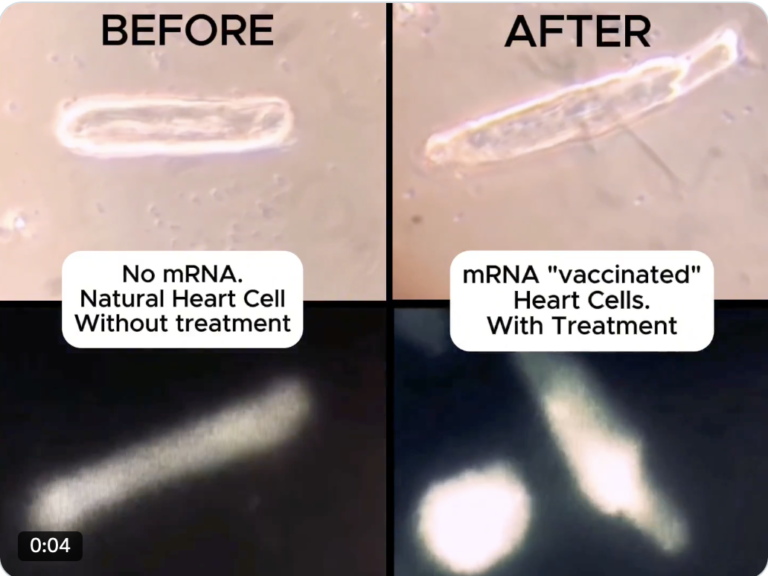 The science behind the risk of myocarditis following mRNA vaccination